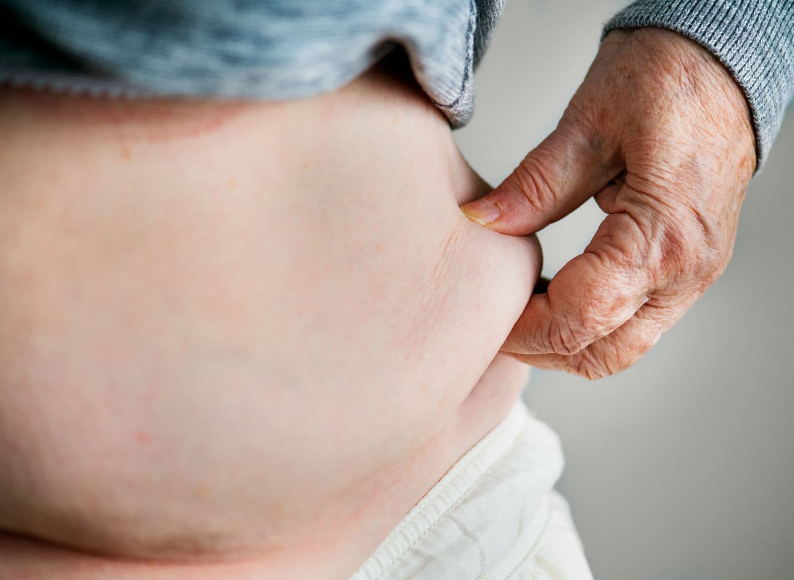 Lilly expands Medicare access as obesity drug market heads toward $130 billion